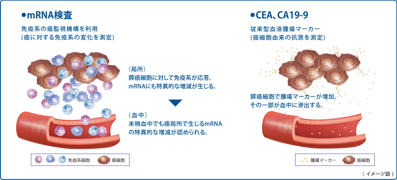 検査原理